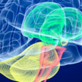 Understanding Cerebral Palsy: Causes, Treatment, and Legal Options