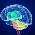 Understanding Cerebral Palsy Conditions