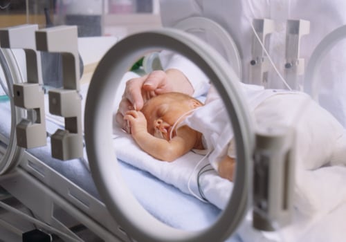Understanding Cerebral Palsy Asphyxia